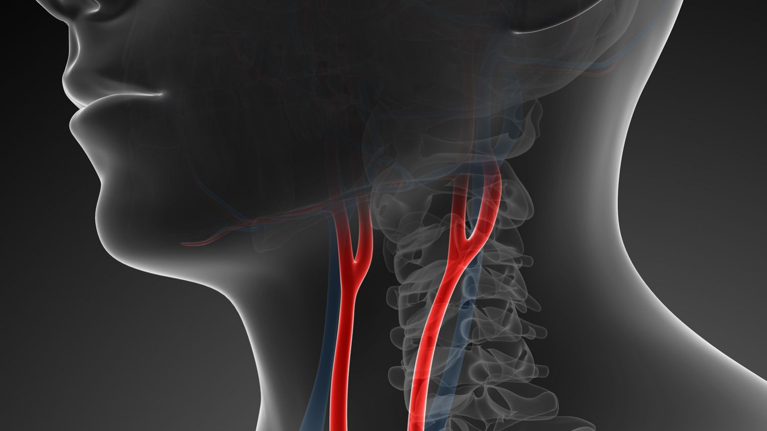 Carotid Artery Graphic